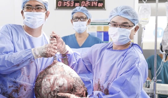 Bụng to bất thường, cô gái 25 tuổi phát hiện u xơ tử cung gần 12kg