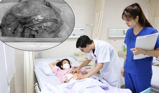 Người phụ nữ có khối u to như thai 7 tháng, nhiều bệnh nguy hiểm