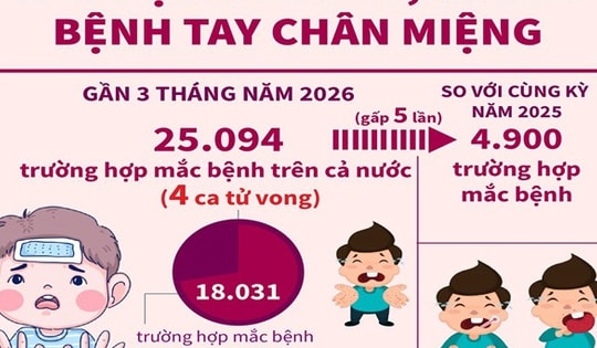 Chủ động phòng, chống bệnh tay chân miệng