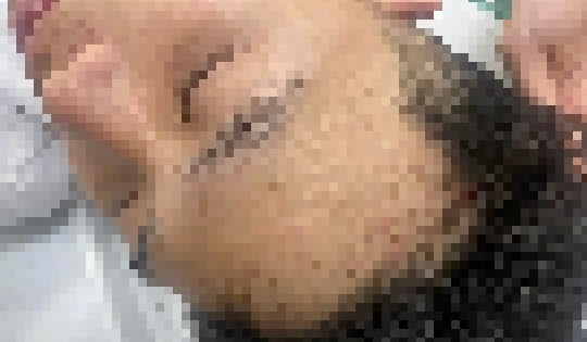 Công an Hà Nội điều tra vụ nam sinh bị nhóm đi ô tô ngược chiều chặn đầu, đánh hội đồng nhập viện