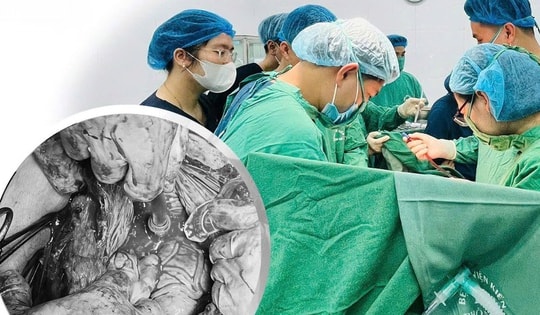 Cứu sản phụ mang thai lần 3 mắc rau tiền đạo trung tâm cài răng lược