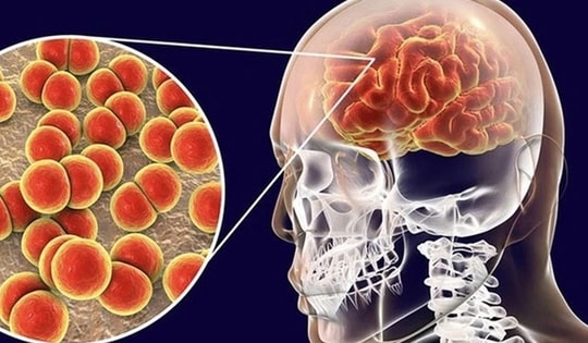 Não mô cầu gây tử vong nhanh, người dân cần làm gì để tự bảo vệ?