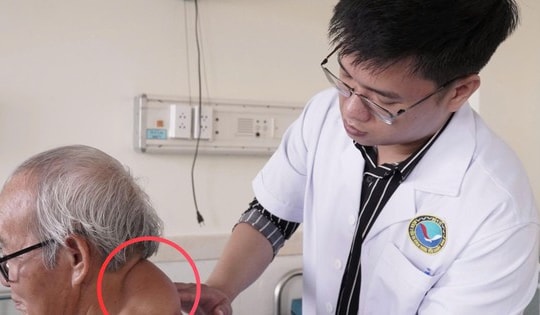 Mang khối u hơn 40 năm, cụ ông 72 tuổi được phẫu thuật thành công