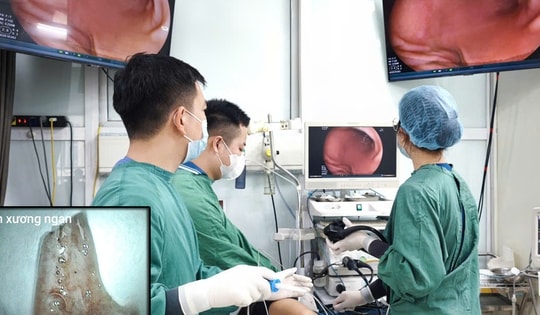 Người đàn ông cấp cứu sau bữa ngan luộc