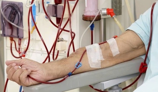 Nhiều bệnh nhân hồi sức nguy cơ suy thận, lọc máu liên tục cần làm sớm, không chờ 'giai đoạn muộn'