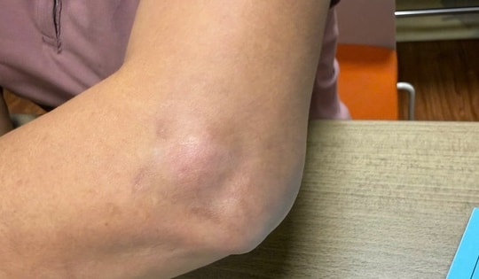 Cảnh báo mạo danh bác sĩ Bạch Mai tiêm thuốc khiến người bệnh gặp biến chứng