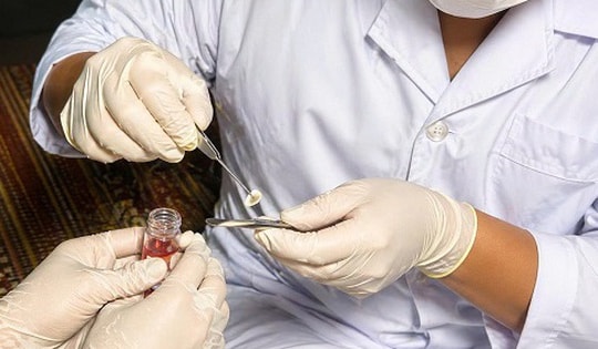 Ca hiến giác mạc đầu tiên tại Bệnh viện Đa khoa Bắc Ninh số 1