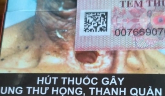 Từ 15/5, không in cảnh báo sức khỏe trên bao bì thuốc lá có thể bị phạt đến 40 triệu