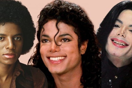 Sự thật về căn bệnh hiếm khiến Michael Jackson phải tẩy trắng da