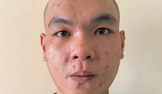 Trộm xe mô tô của cha ruột đem bán