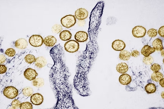 Hantavirus khiến 3 người trên du thuyền MV Hondius tử vong nguy hiểm ra sao?