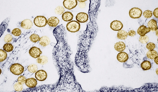 WHO đánh giá nguy cơ lây lan virus Hanta trong cộng đồng ở ‘mức thấp’