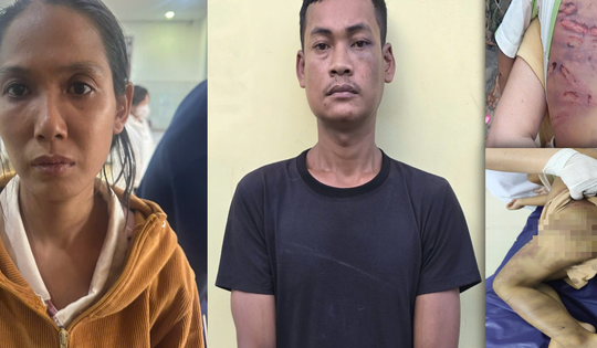 Bắt khẩn cấp mẹ ruột và 'cha dượng' bạo hành bé trai 2 tuổi tại TPHCM