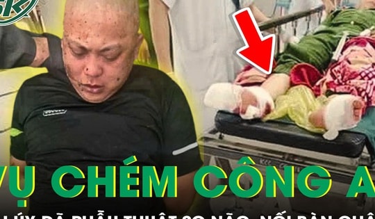Đại úy công an bị chém tại trụ sở đã được nối lại bàn chân và phẫu thuật sọ não