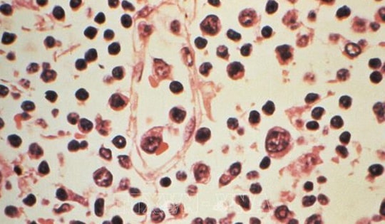 Đài Loan (Trung Quốc) ghi nhận 1 ca tử vong do nhiễm virus Hanta