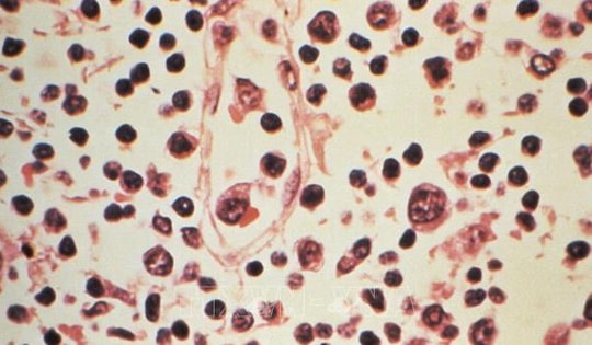 Tỷ lệ tử vong do nhiễm virus Hanta tăng cao, Chile nâng mức cảnh báo y tế