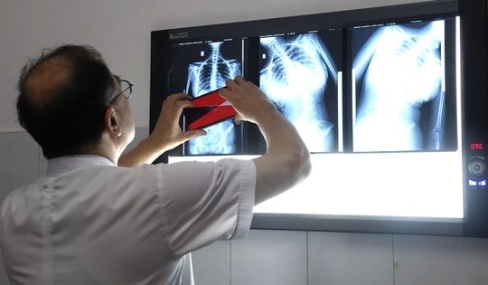 Dấu hiệu nhiều phụ huynh bỏ qua khiến trẻ biến dạng cột sống