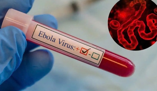 TPHCM tăng cường giám sát trước nguy cơ dịch Ebola xâm nhập