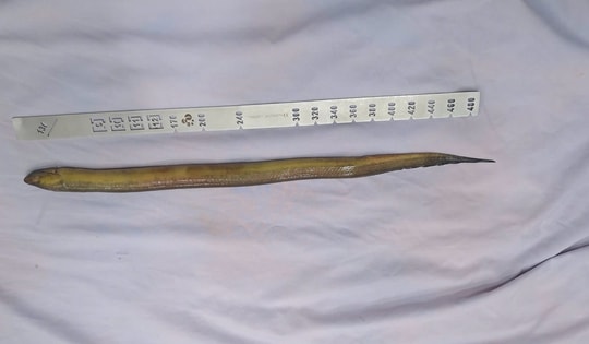 Đau bụng dữ dội, bác sĩ phát hiện con lươn dài hơn 50cm trong
ổ bụng người đàn ông