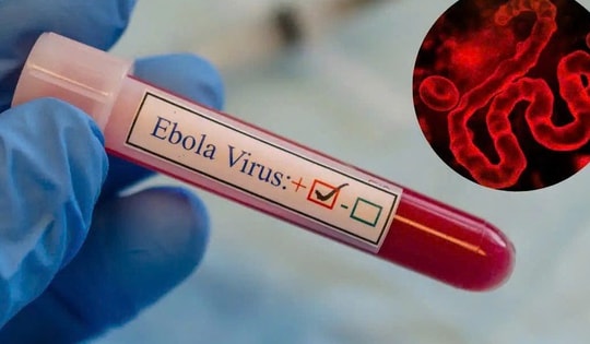 WHO cảnh báo khẩn về Ebola, Bộ Y tế yêu cầu tăng cường giám sát, ngăn dịch xâm nhập