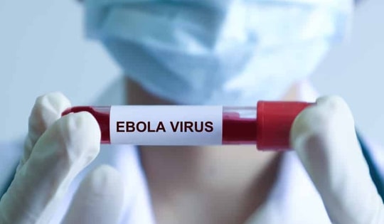 Tỉ lệ tử vong do Ebola có thể lên đến 90%, Bộ Y tế nêu các triệu chứng thường gặp khi mắc bệnh
