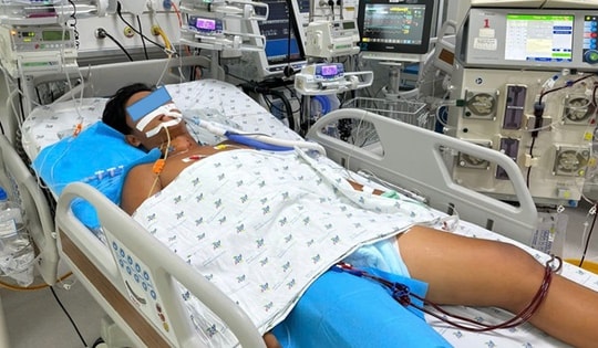Đá bóng dưới trời nắng, bé trai sốc nhiệt biến chứng huỷ cơ, suy đa cơ quan