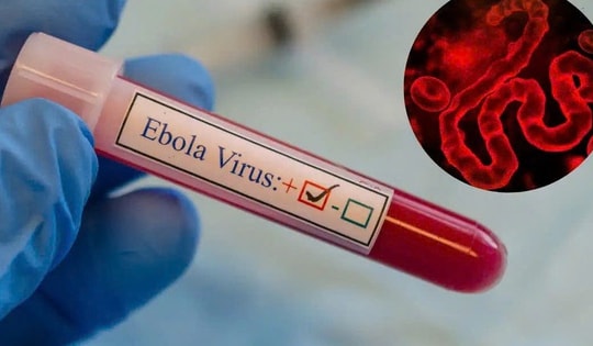 Dịch bệnh Ebola diễn biến phức tạp tại Châu Phi nhưng người dân không nên hoang mang