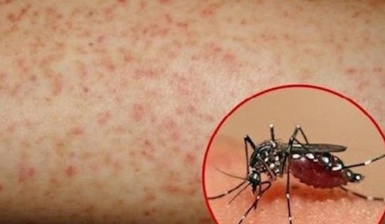 Hơn 1.100 ca mắc sốt xuất huyết, Lâm Đồng kích hoạt các biện pháp phòng, chống dịch