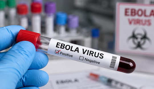 Bác sĩ Bạch Mai chỉ ra quy tắc '2 - 5 - 30' trong ngăn chặn Ebola