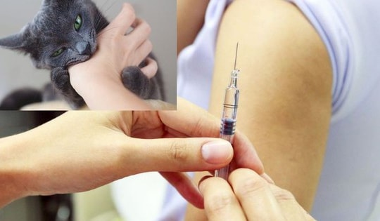 Nguy cơ bệnh dại gia tăng mùa nắng nóng, cần tiêm phòng ngay khi bị chó mèo cắn
