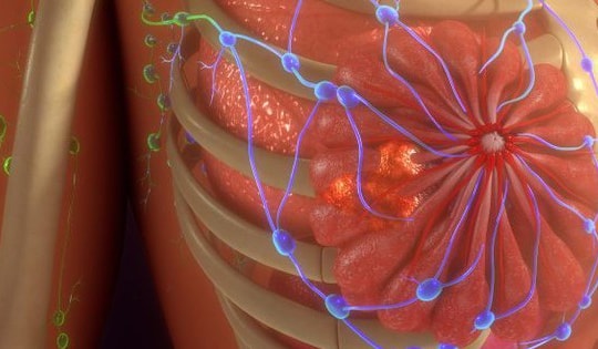 Công nghệ điều trị ung thư mới không cần dùng thuốc
