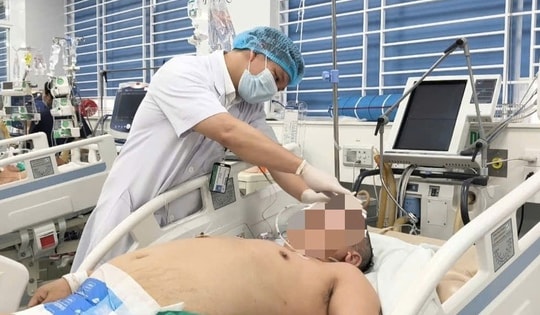 Sau trận nhậu, người đàn ông gần 100 kg xuất huyết não suýt mất mạng