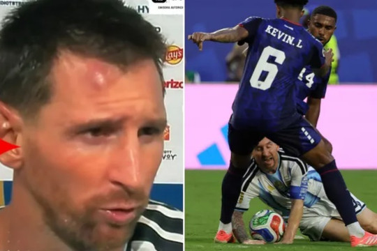 Nhật ký World Cup 2026: Tuyển Pháp nhận tin dữ, Messi dính chấn thương sau chiến thắng nghẹt thở
