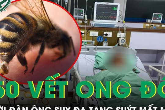 Đi bắt cá bị ong vò vẽ đốt 150 vết, người đàn ông suy đa tạng suýt mất mạng