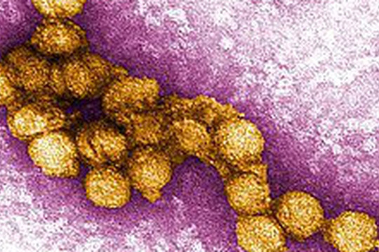 Nguy cơ lây lan virus Tây sông Nile ở châu Âu
