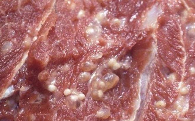 Cục Y tế dự phòng (Bộ Y tế) khuyến cáo 4 điều cần làm để phòng nhiễm sán lợn