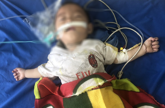 Bé trai 12 tháng tuổi nguy kịch vì ngộ độc thuốc phiện