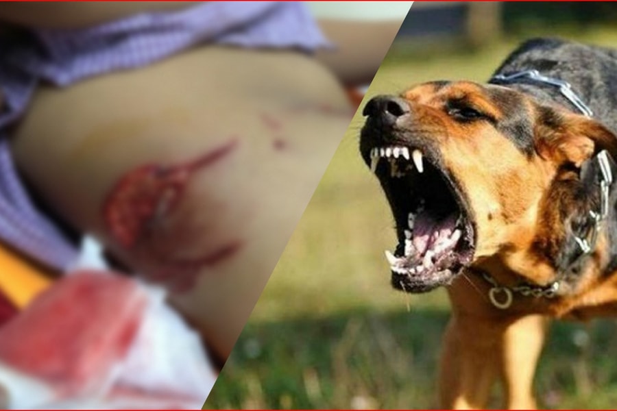 Bé trai 7 tuổi bị chó lai nặng 30kg tấn công kinh hoàng