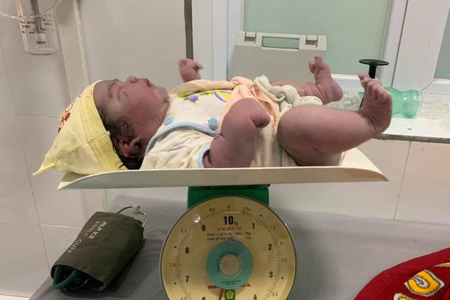 Hy hữu: Bé gái nặng 5,5 kg chào đời bằng phương pháp sinh thường
