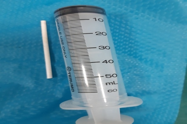 Ăn kẹo mút, bé 2 tuổi nuốt luôn que 5cm vào dạ dày