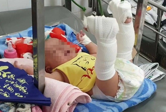 Bắt giữ người cha bạo hành con trai 4 tháng tuổi xuất huyết não ở Sài Gòn