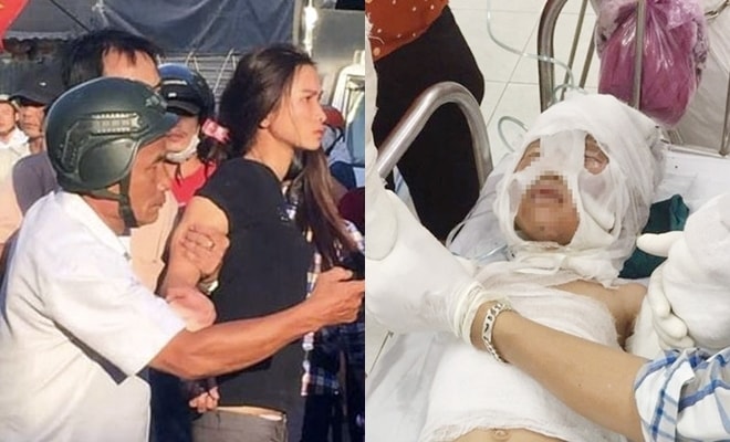 Dì ruột tẩm xăng đốt cháu 6 tuổi bỏng nặng vì khoản nợ 3,9 triệu của bố