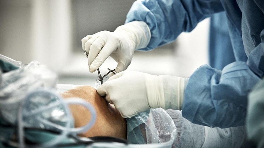 Bé gái bị máy xay đá cuốn tóc lột hết da đầu