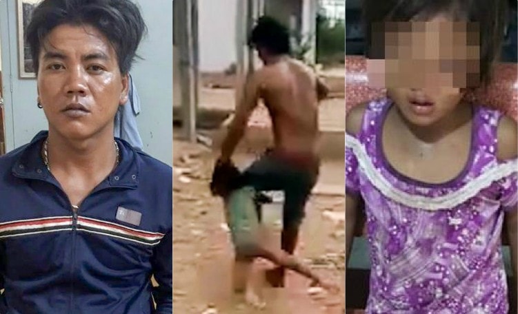 Khởi tố, bắt giam người cha đánh con gái 6 tuổi đa chấn thương