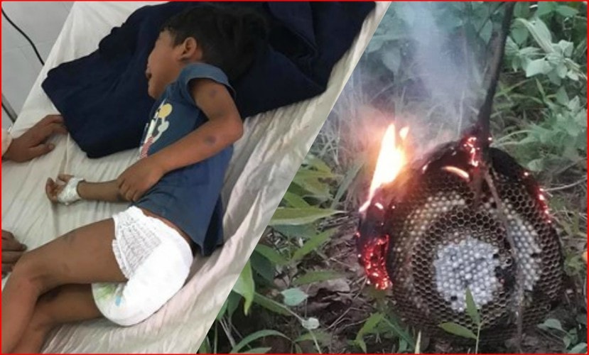 Ong đốt 2 anh em ruột, bé 3 tuổi tử vong, bé 5 tuổi nguy kịch