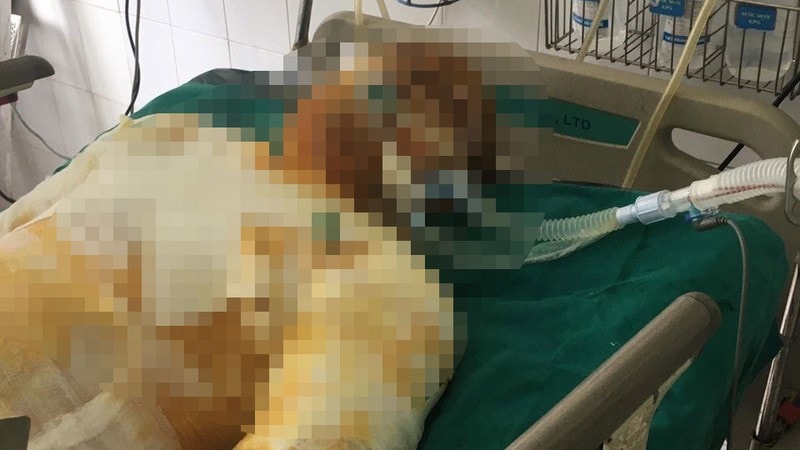 Khởi tố kẻ đổ xăng đốt đồng nghiệp