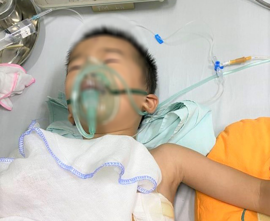 Cứu sống bé trai 4 tuổi bị trâu húc thủng phổi