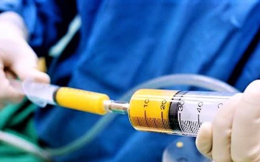 Khách tử vong khi nâng ngực, chủ phòng khám bị xử lý thế nào?