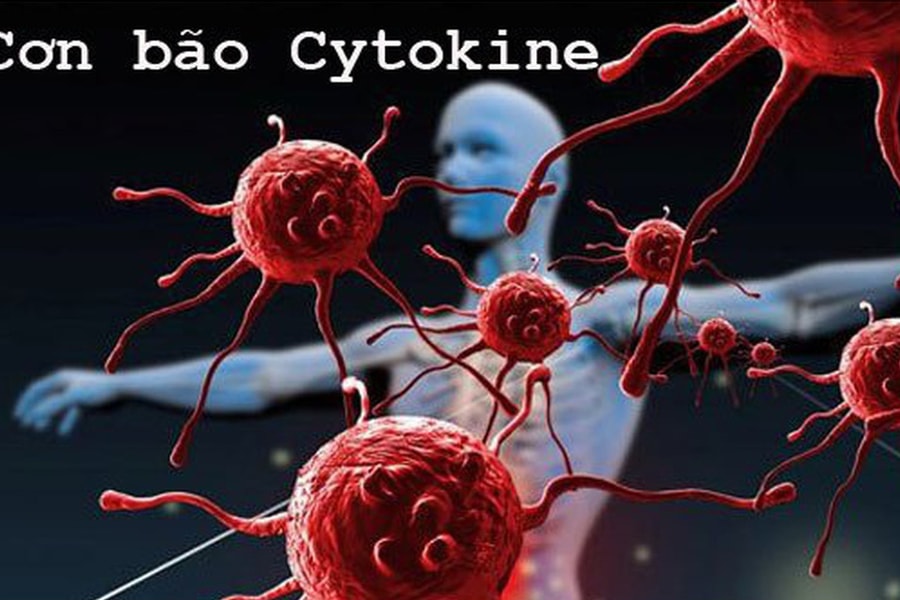 "Bão Cytokine" mà Phi Nhung gặp phải là gì, nguy hiểm như thế nào với người mắc COVID-19?
