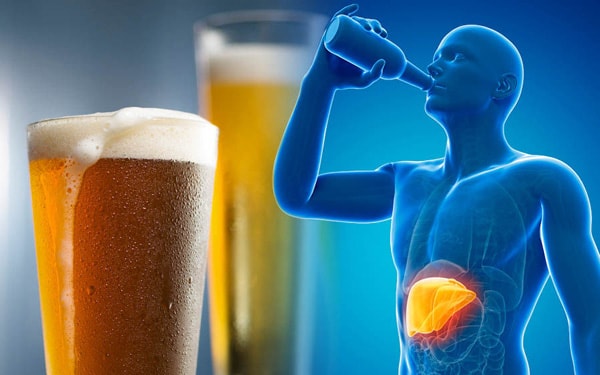 Bệnh gan do rượu: Triệu chứng và yếu tố nguy cơ ai cũng cần phải biết